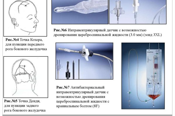 Что такое кракен маркет